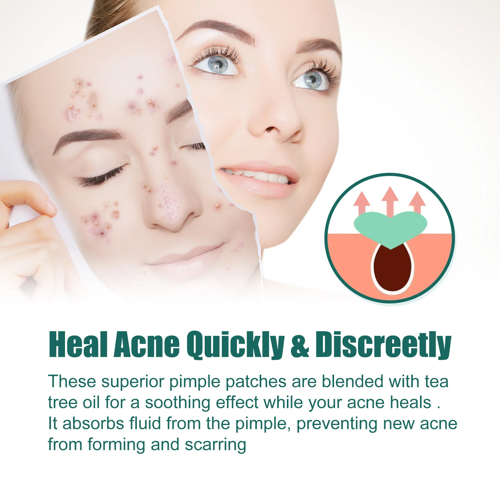 Heart-Shaped Colorful Acne Patches for Clear Skin - Image 10