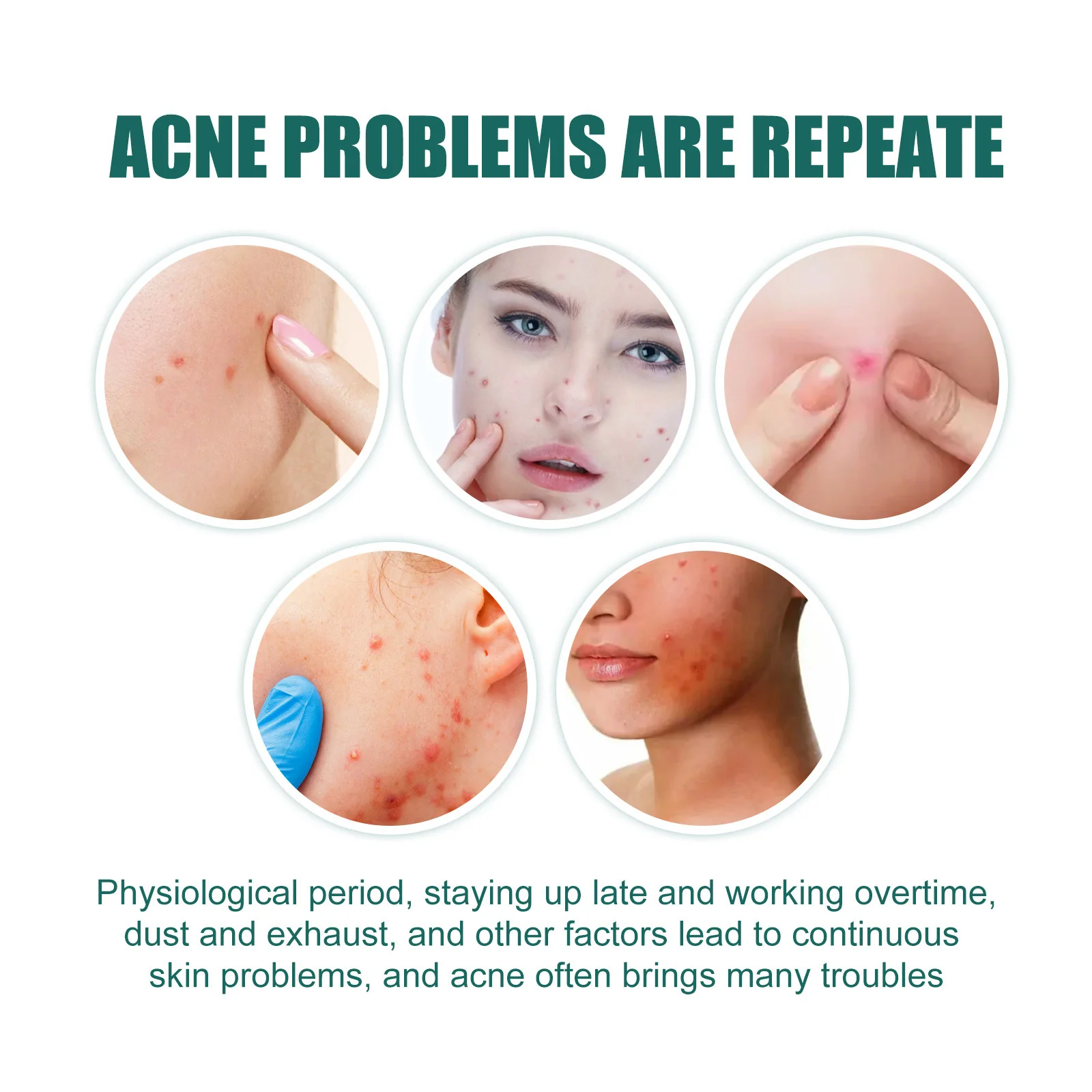 Heart-Shaped Colorful Acne Patches for Clear Skin - Image 11