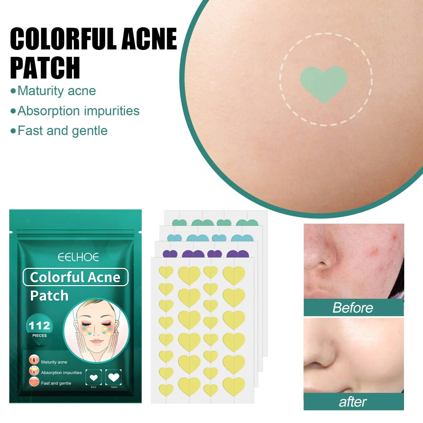 Heart-Shaped Colorful Acne Patches for Clear Skin - Image 9