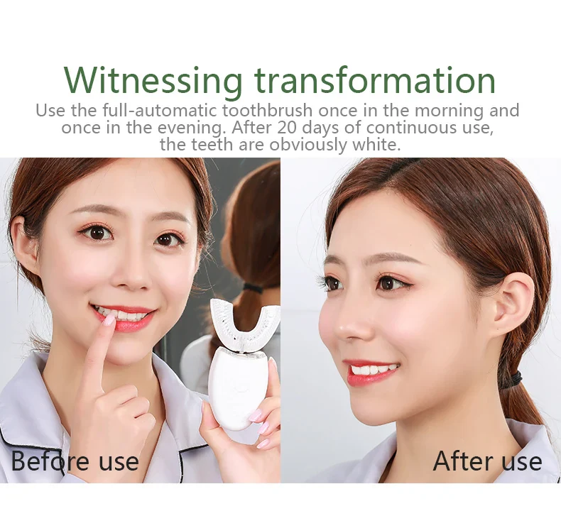 Intelligent U-Type Toothbrush 360 Degrees Sonic Electric Automatic with USB Charge Waterproof Silicon Head for Oral Care - Image 12