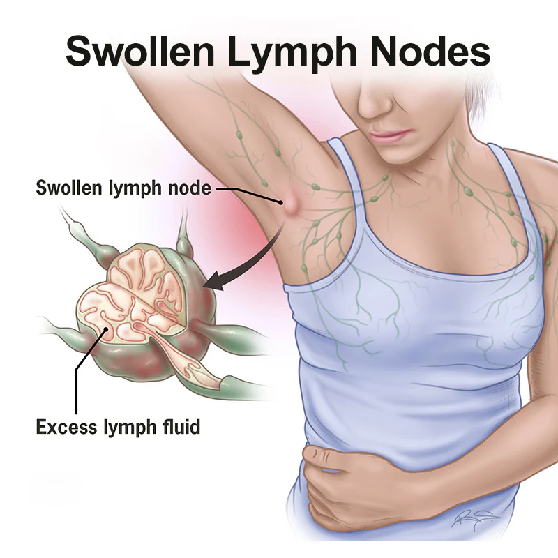 Lymphatic Health Adhesive Patch for Swelling and Detox - Image 11